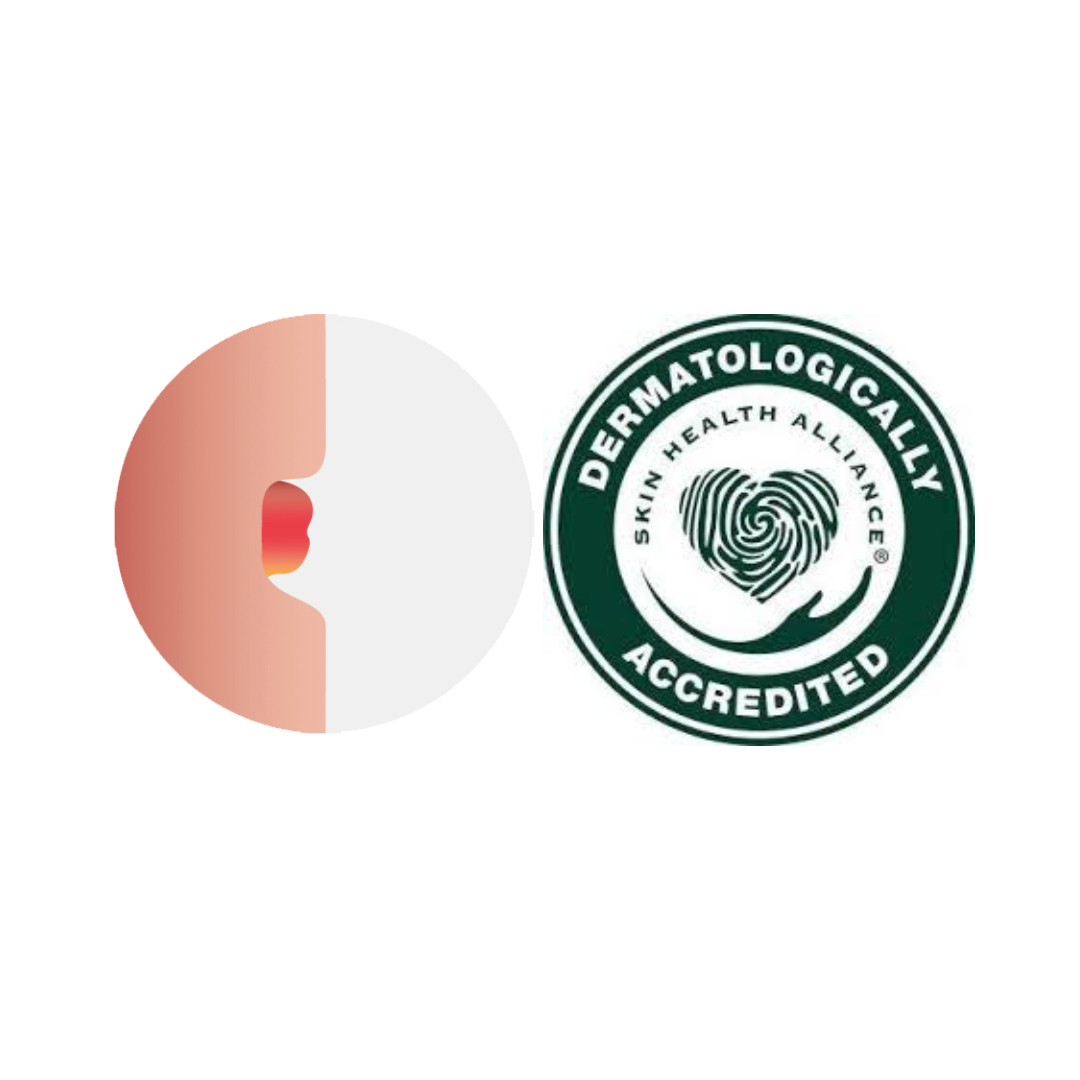 Aurum 2™ Convex Uro